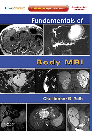 FUNDAMENTALS OF BODY MRI: EXPERT CONSULT- ONLINE AND PRINT By Roth Christopher
