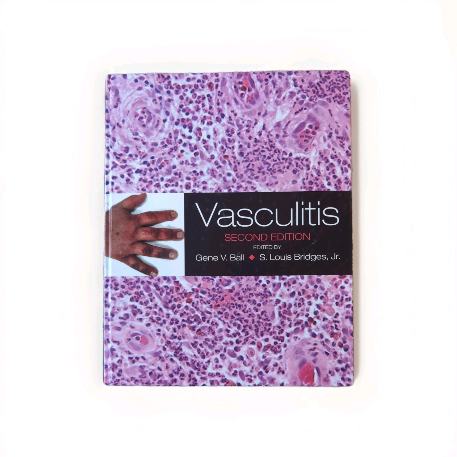 Vasculitis by Gene V. Ball and S. Louis Bridges (2008, Hardcover)