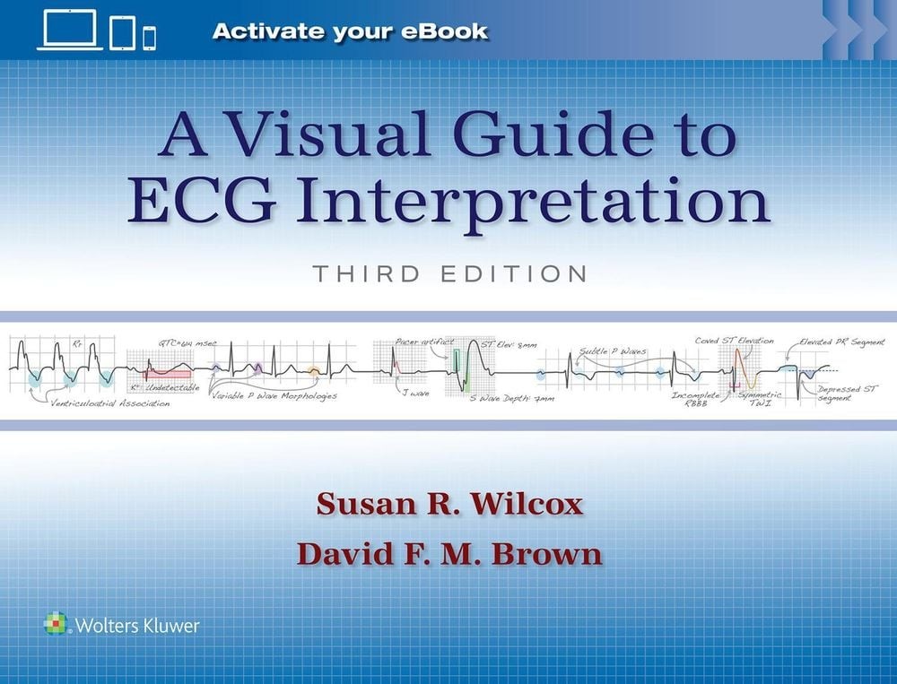 A Visual Guide to ECG Interpretation: Print + eBook with Multimedia by Susan Ren