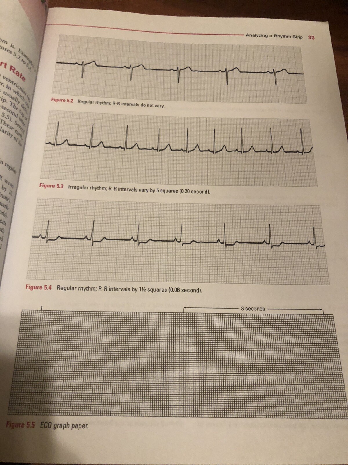 ECG Workout : Exercises in Arrhythmia Interpretation by Jane Huff (2016,…