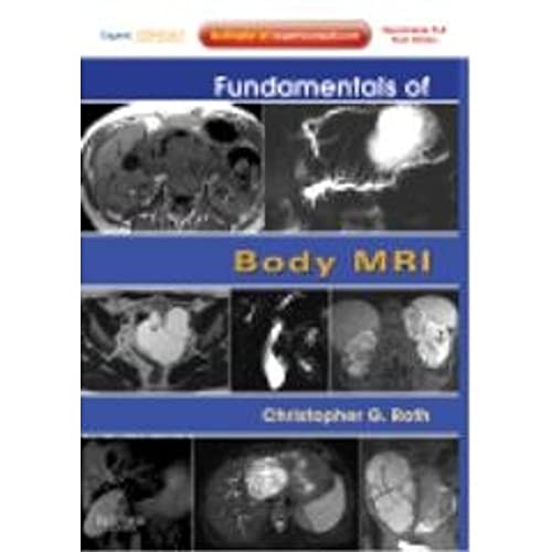 Fundamentals of Body MRI: Expert Co…, Roth, Christoph