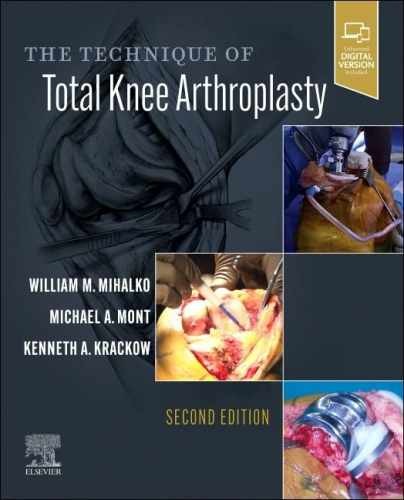 The Technique of Total Knee Arthroplasty – Hardcover, by Mihalko MD PhD – New