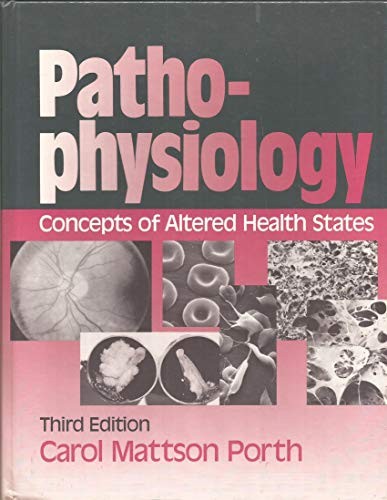 Pathophysiology Concepts of Al – GOOD