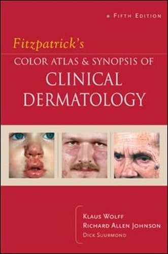 Fitzpatrick’s Color Atlas and Synopsis of Clinical Dermatology: Fifth Edition