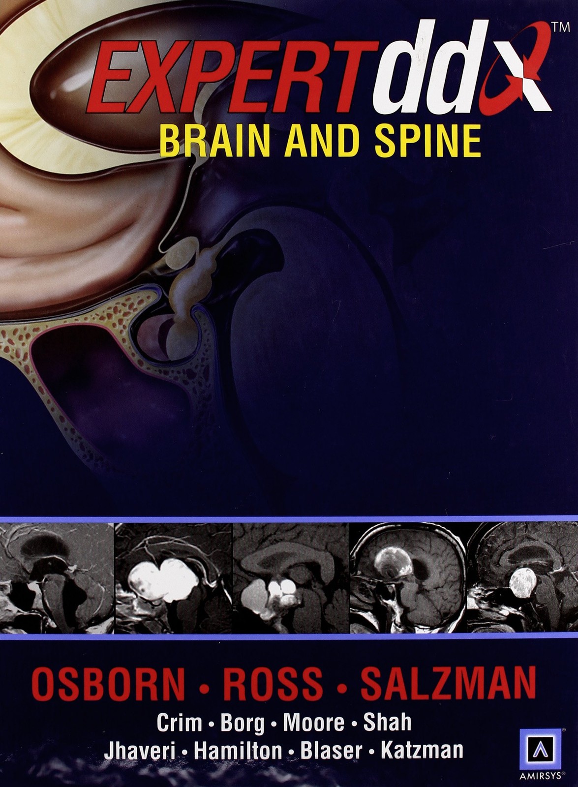 Expertddx: Brain and Spine
