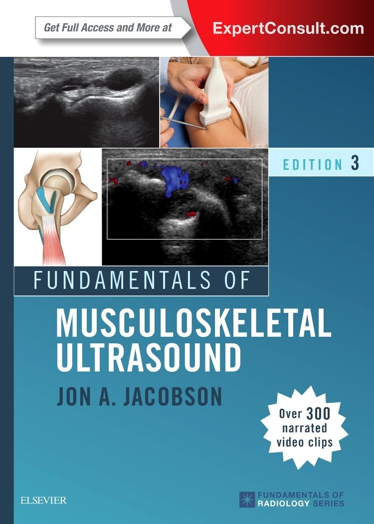 Fundamentals of Musculoskeletal Ultrasound by Jon A. Jacobson