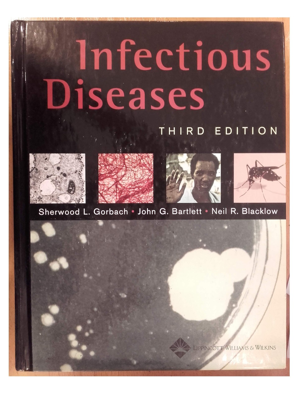 Infectious Diseases