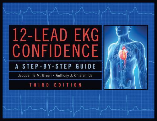12-Lead EKG Confidence: A Step-By-Step Guide