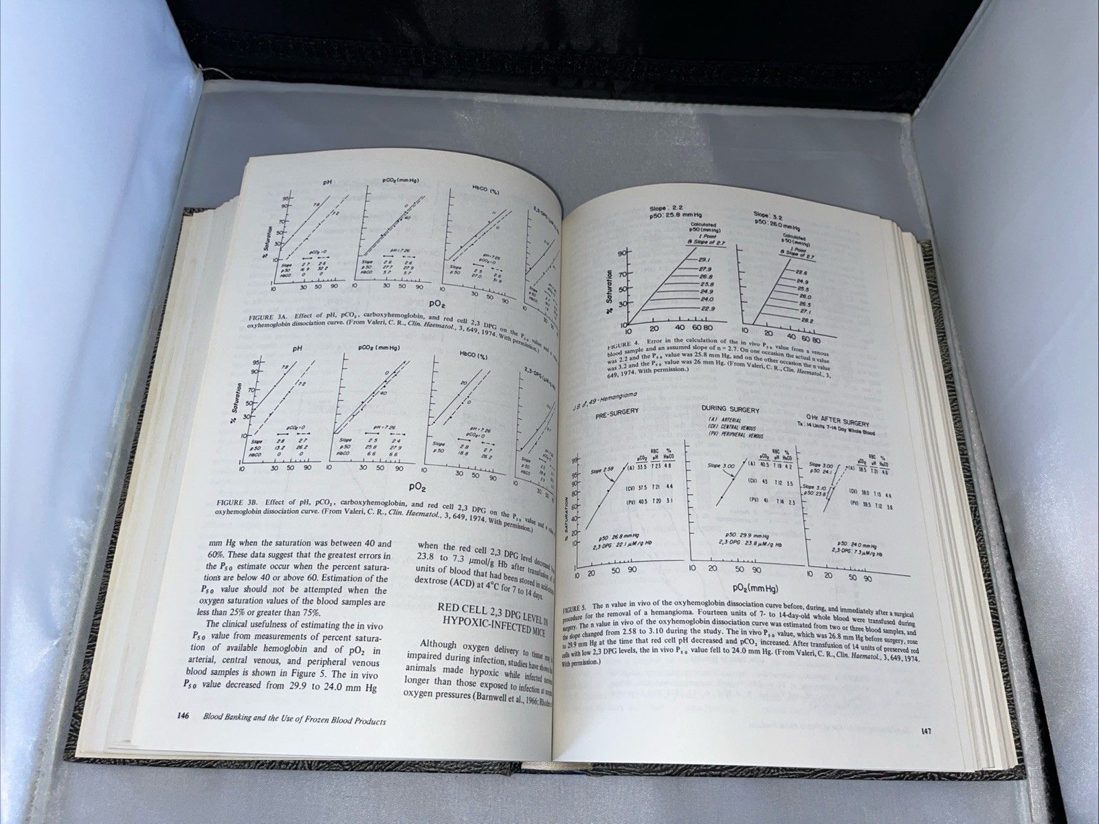 C. R. Valeri Signed 1976 Blood Banking & The Use Of Frozen Blood Products 1st Ed