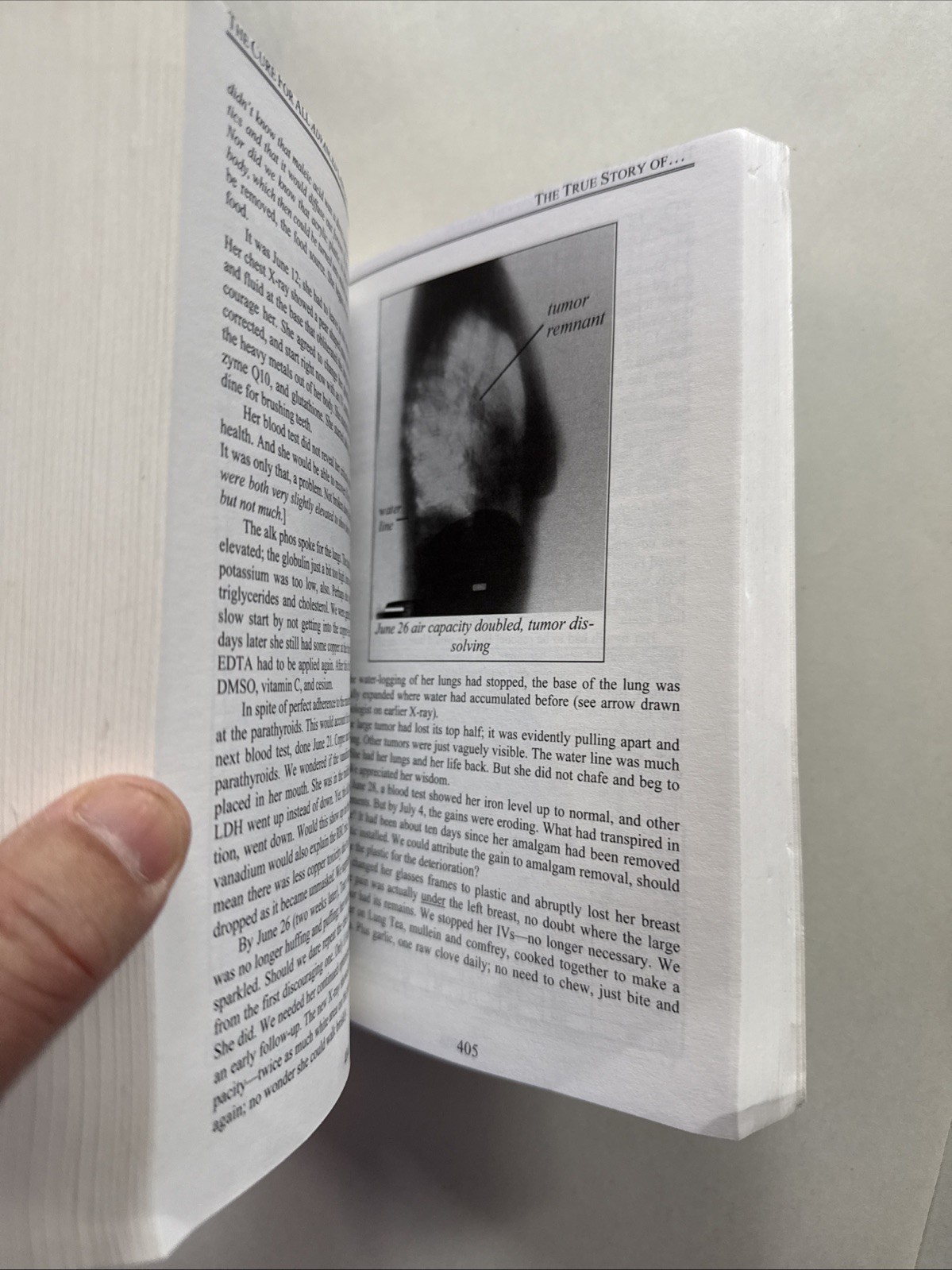 The Cure For All Advanced Cancers by Hulda Regehr Clark – Top Portion Cut
