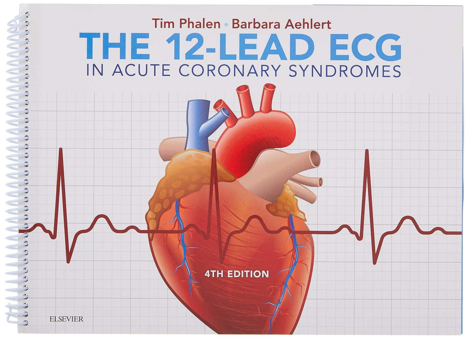 THE 12-LEAD ECG IN ACUTE CORONARY SYNDROMES BY Barbara J. Aehlert Msed Bspa Rn