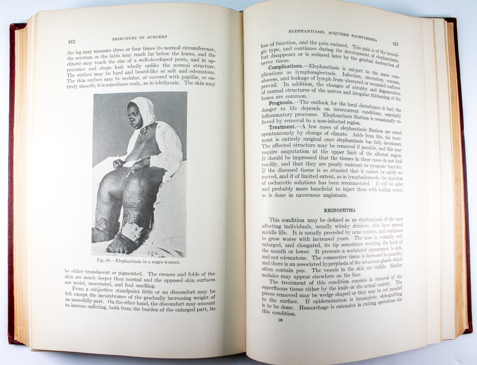 Vintage Medical Surgical Book w Pictures Principles of Surgery W A Bryan 1913
