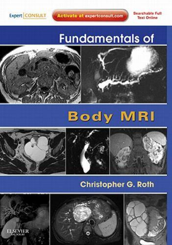 Fundamentals of Radiology Ser.: Fundamentals of Body MRI : Expert Consult-…