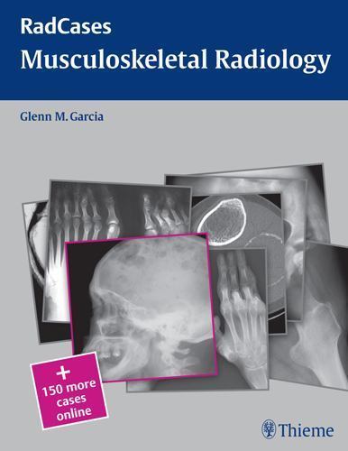 Radcases Plus Q&A Ser.: Musculoskeletal Radiology by Glenn M. Garcia (2010,…