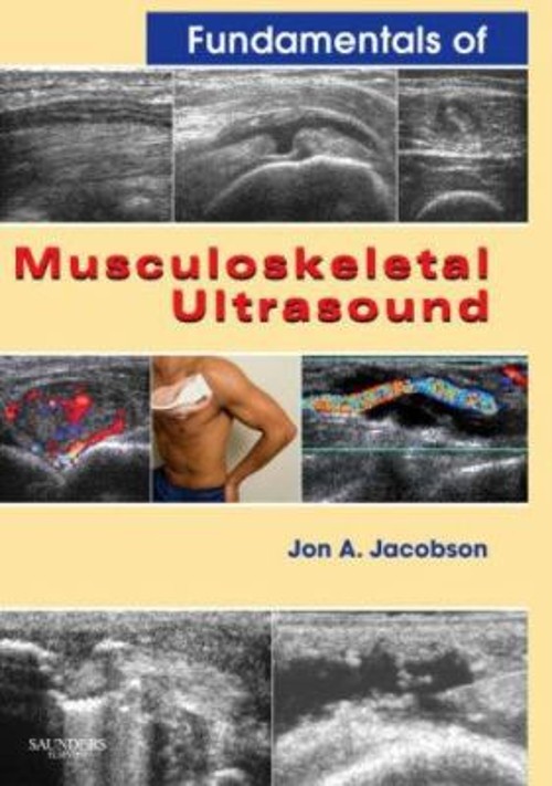 Fundamentals of Musculoskeletal Ultrasound Perfect Jon A. Jacobso