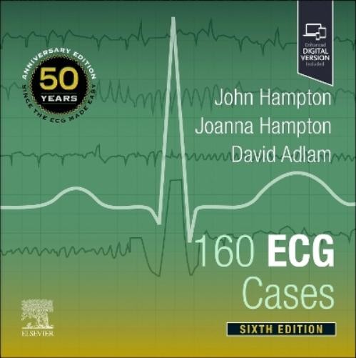 John Hampton Joanna Hampton David Adlam 160 ECG Cases (Paperback)