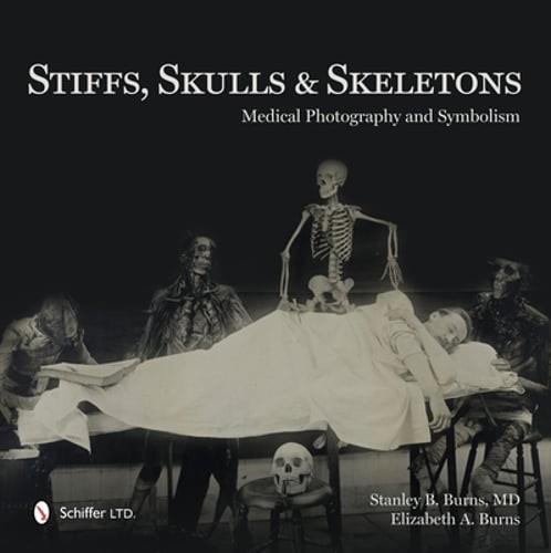 Stiffs, Skulls & Skeletons: Medical Photography and Symbolism by Burns: Used