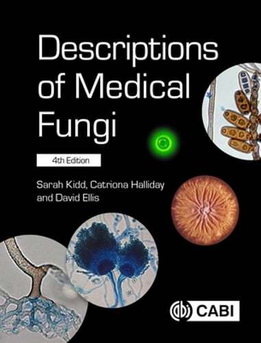 Descriptions of Medical Fungi by Sarah Kidd: Used