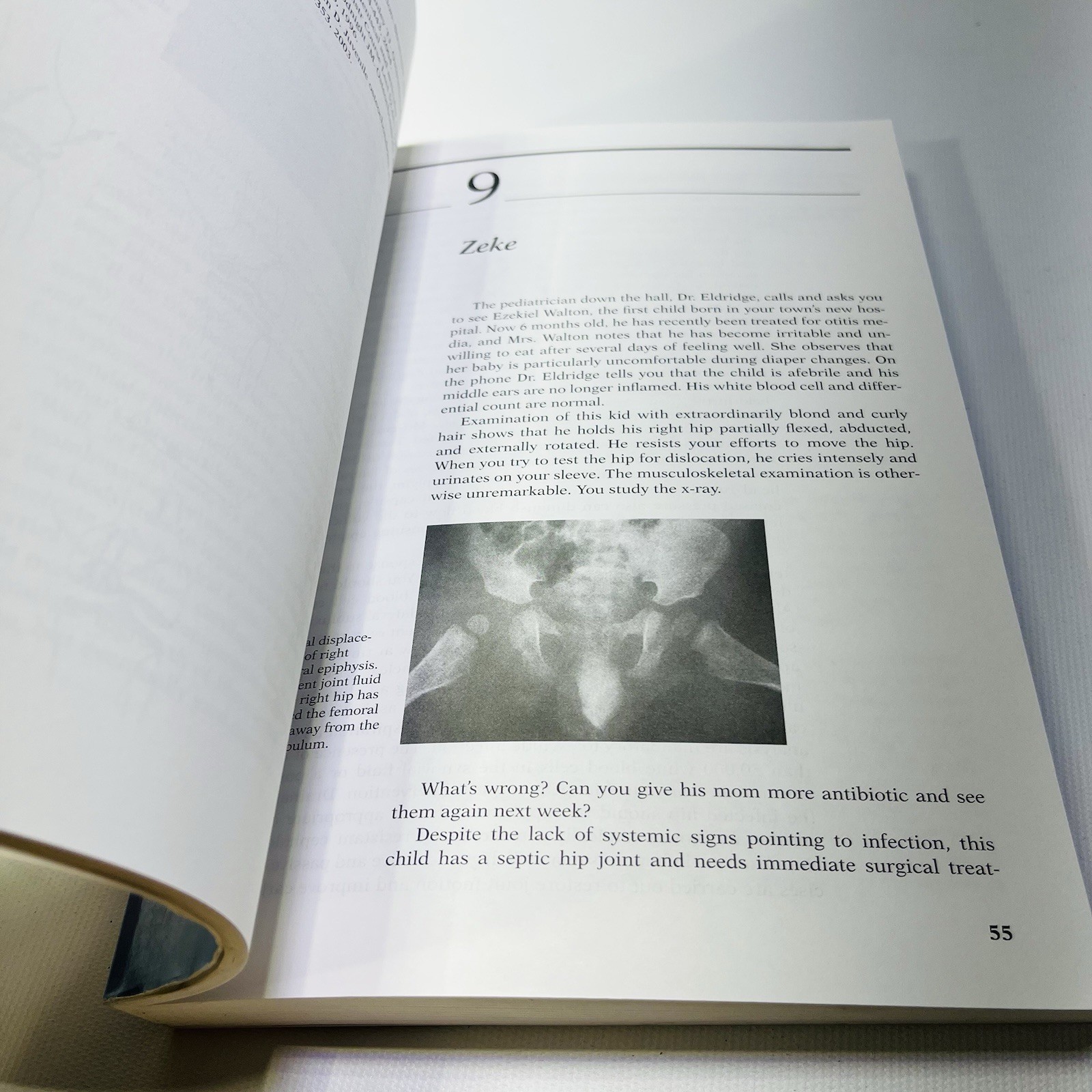 One Hundred Orthopedic Conditions Every Doctor Should Understand, Second Edition