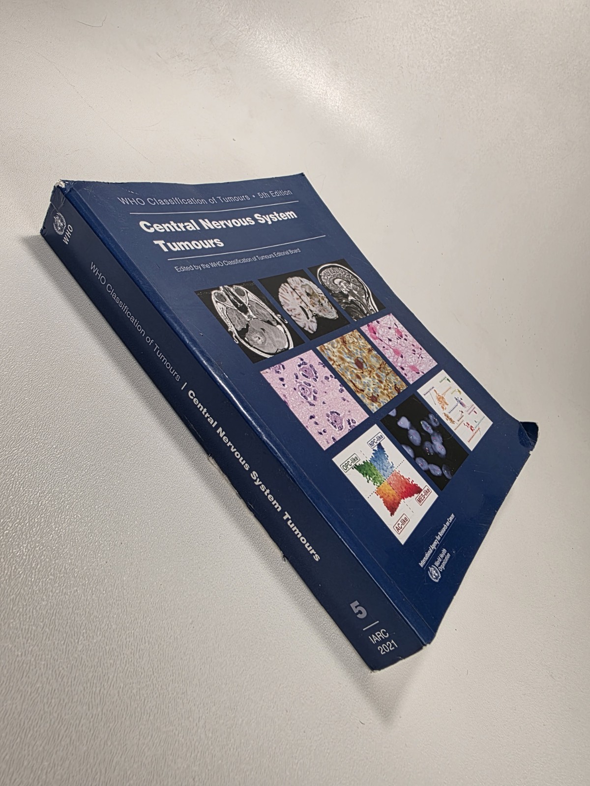 Central Nervous System Tumours 5th edition Fast Shipping Free Shipping..
