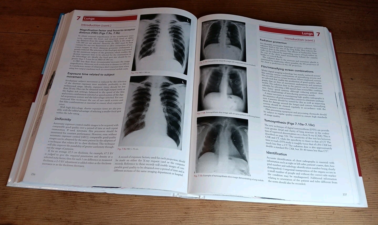 Clark’s Positioning in Radiography 13E 13th Edition A Stewart Whitley HC Text