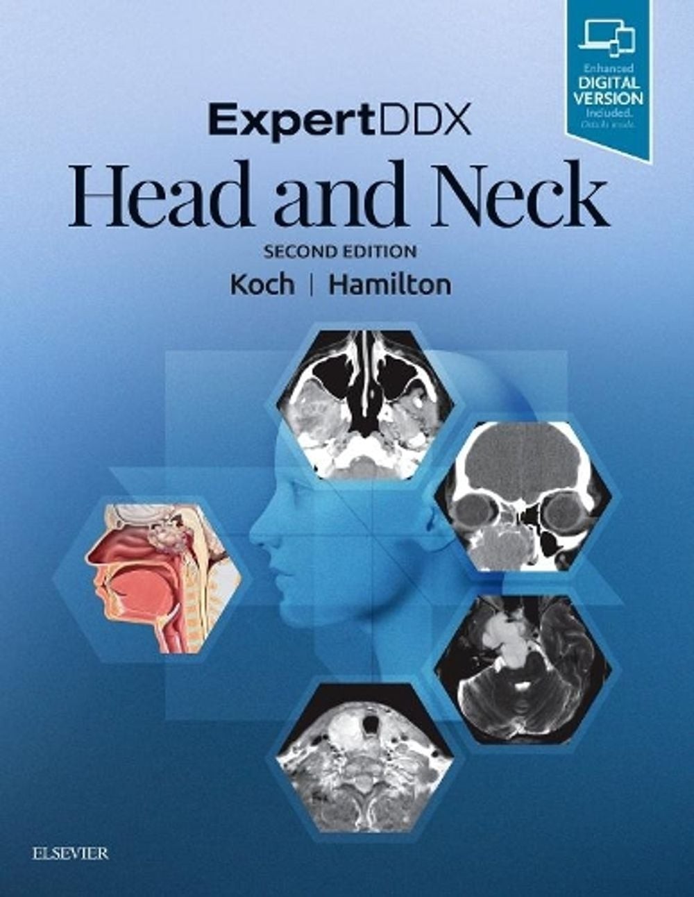 ExpertDDX: Head and Neck by Bernadette L. Koch (English) Hardcover Book