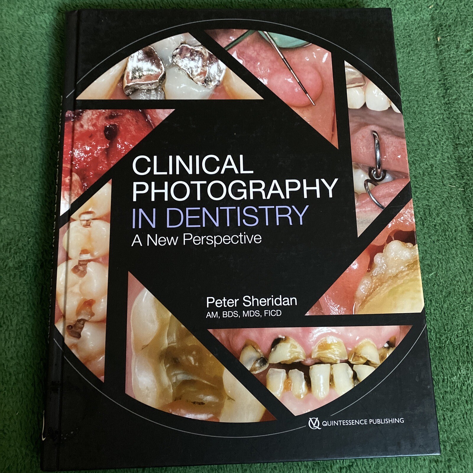 Clinical Photography in Dentistry