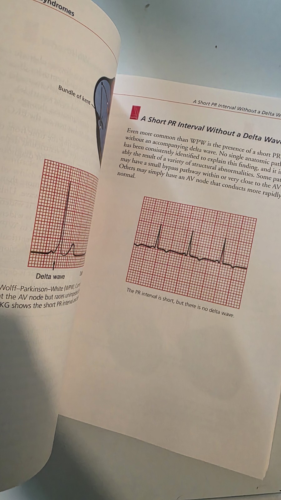 The Only EKG Book You’ll Ever Need Ninth Edition