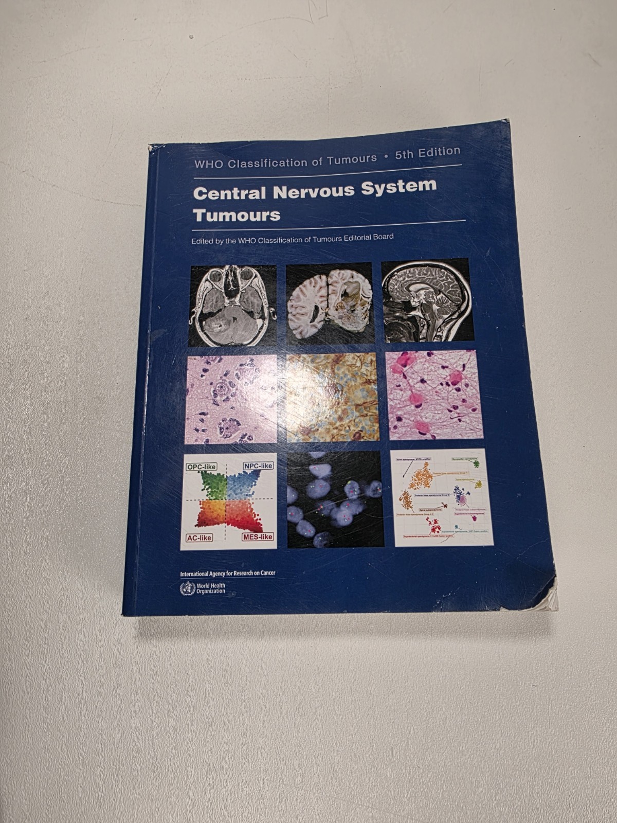 Central Nervous System Tumours 5th edition Fast Shipping Free Shipping..