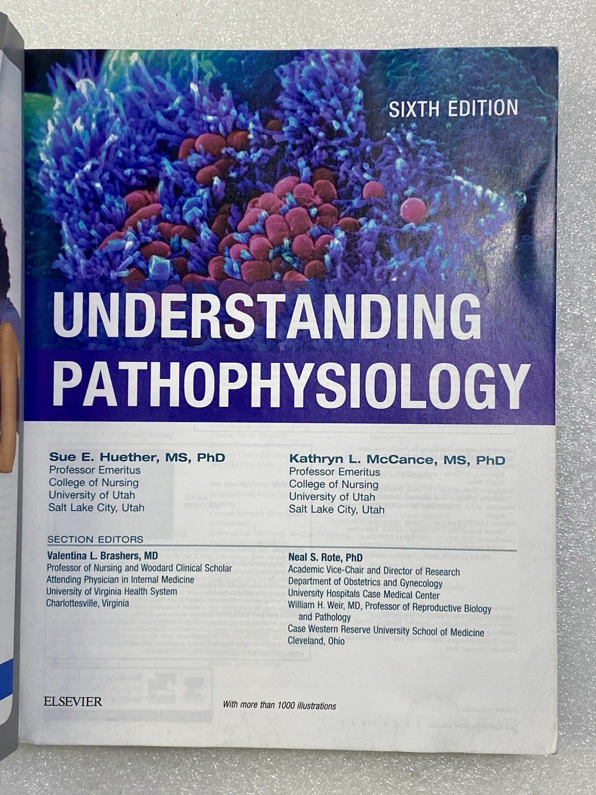 Understanding Pathophysiology by Kathryn L. McCance and Sue E. Huether (2016,…