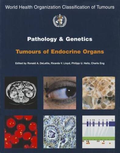 Pathology and Genetics of Tumours of Endocrine Organs (IARC WHO Classific – GOOD