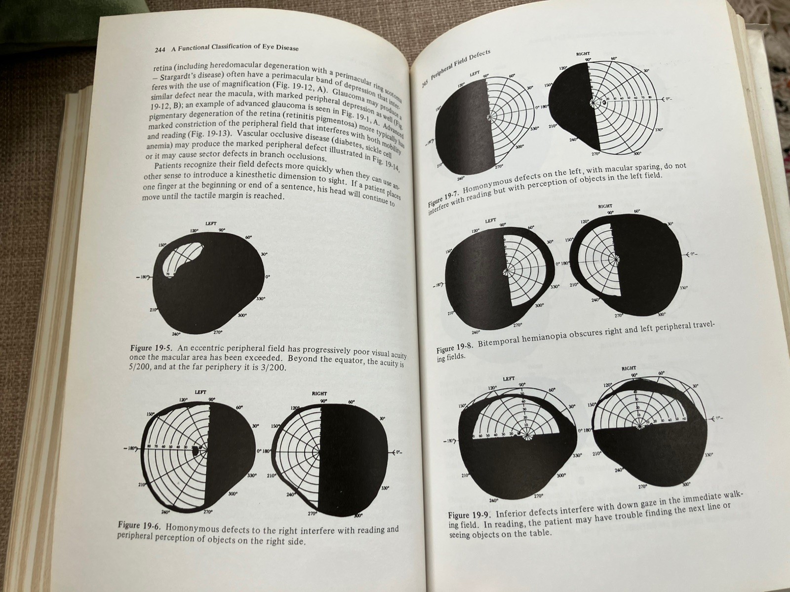 CLINICAL LOW VISION By Eleanor E Faye study textbook vintage optics 1976 vgc