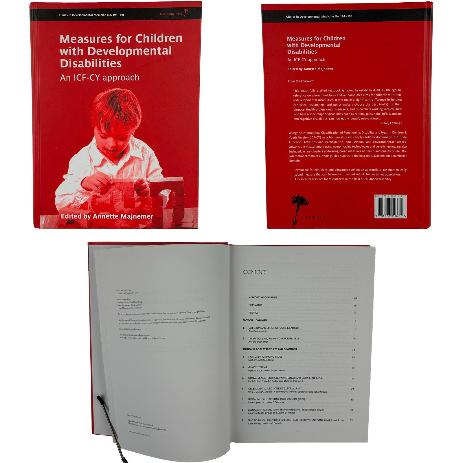 Measures for Children with Developmental Disabilities ICF-CY Majnemer 2012 HC