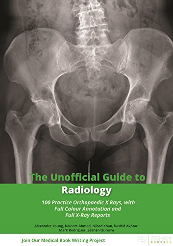 THE UNOFFICIAL GUIDE TO RADIOLOGY: 100 PRACTICE By Alexander Young & NEW